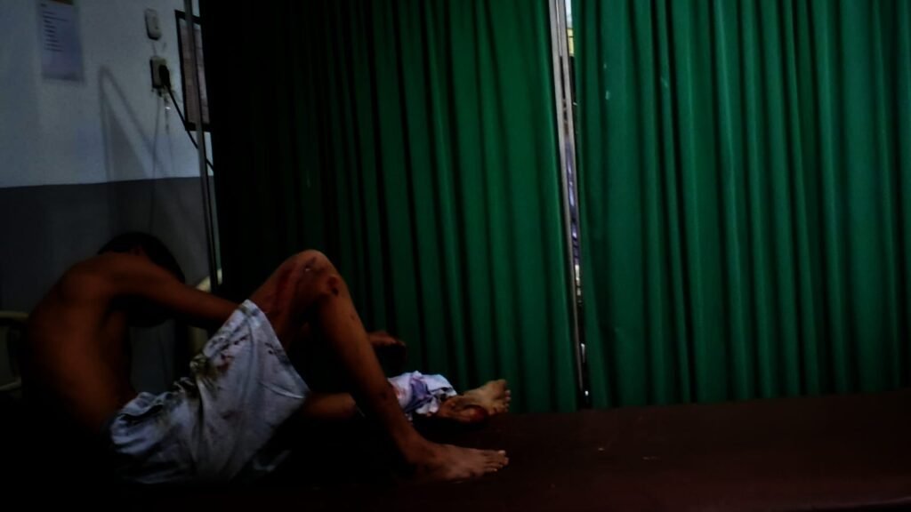 Kendaraan Keluar Jalur di Jalan Manganitu-Tahuna, Siswa 16 Tahun Luka dan Patah Kaki